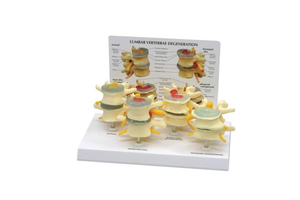zestaw modeli kręgów 4-etapowych- 1019512 3b scientific modele anatomiczne 2